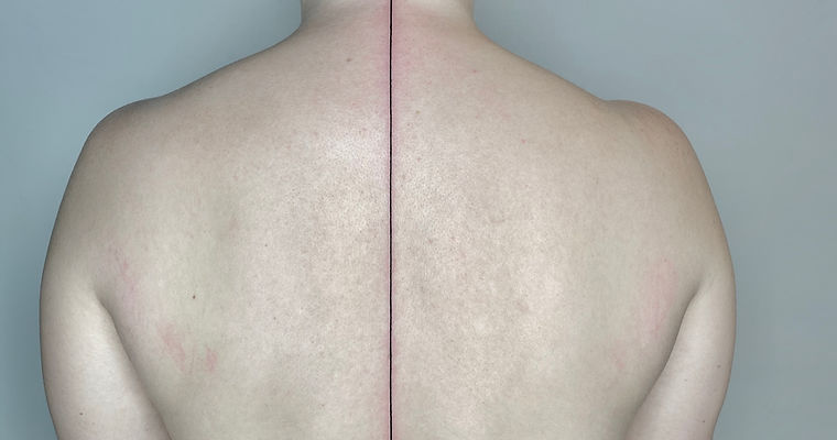 Minimal geometric line tattoo down the back by SixtyInk
